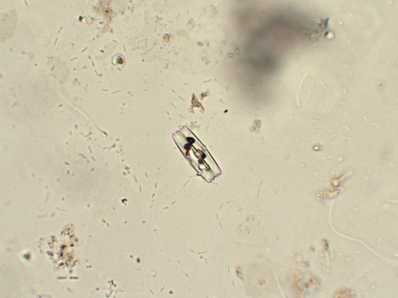 Prima alga osservata